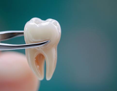 It is important to understand the cost of your tooth extraction